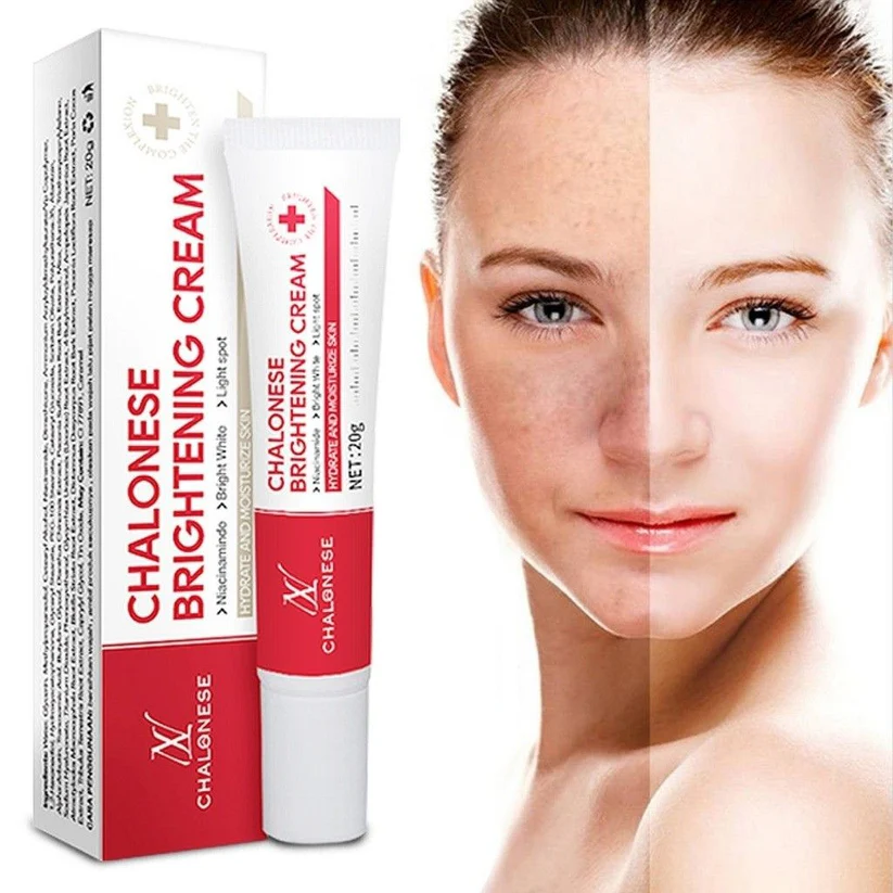 26c1266ea4ed21434f3bb31a2dc97630 Chalonese Brightening Cream - Image 1